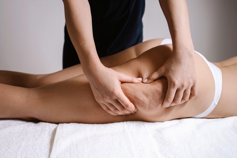 Introbild Anti Cellulite Massage – Welche Massage hilft bei Cellulite?