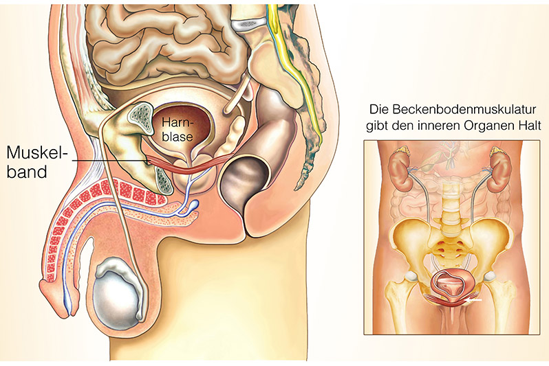 Darstellung Bodenmuskulatur, Muskelband