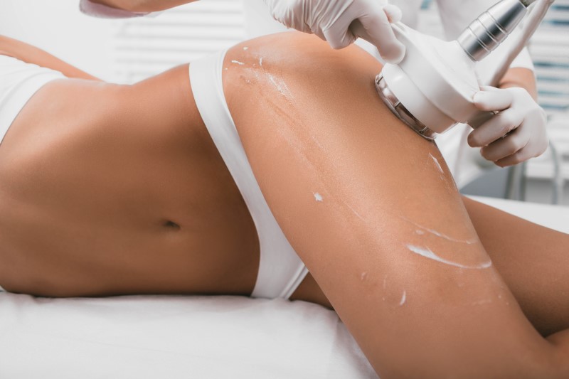 Cellulitestellen von Frau werden mit Massagegerät behandelt